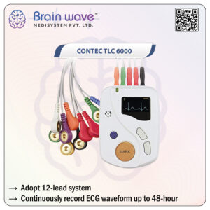 Contec ECG Holter System TLC6000 (12 Lead)